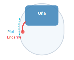 Gráfico de una uña que muestra piel encarne Uña que muestra la piel encarne