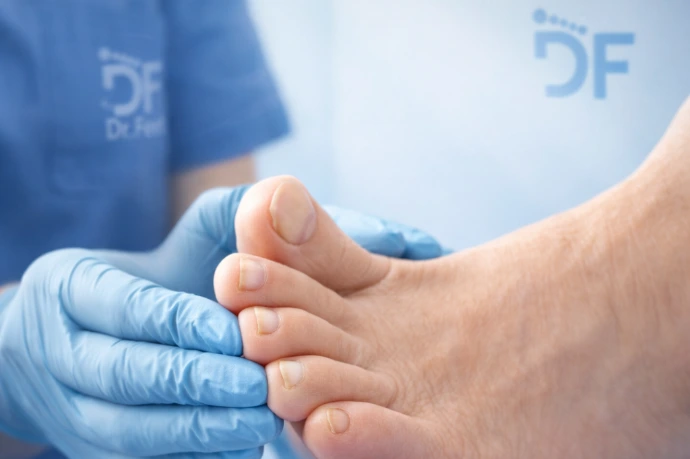 Cuidado profesional orientado a mejorar la apariencia y condición de uñas afectadas por onicomicosis, con orientación para seguimiento adecuado.